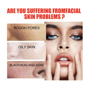 Tender Skin Care Solution